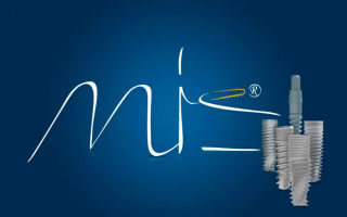 Израильская система имплантации MIS
